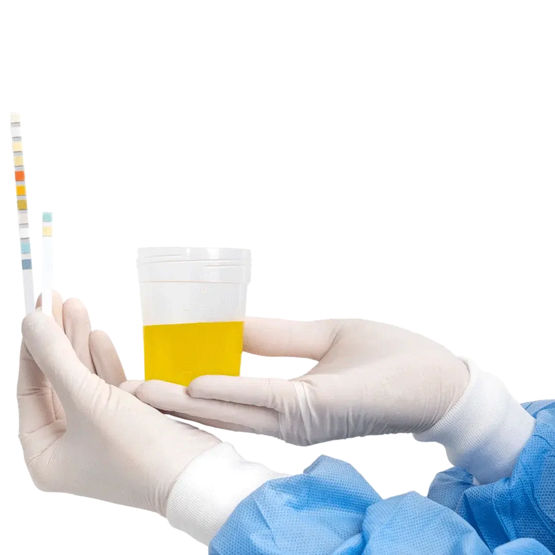Urine Analysis