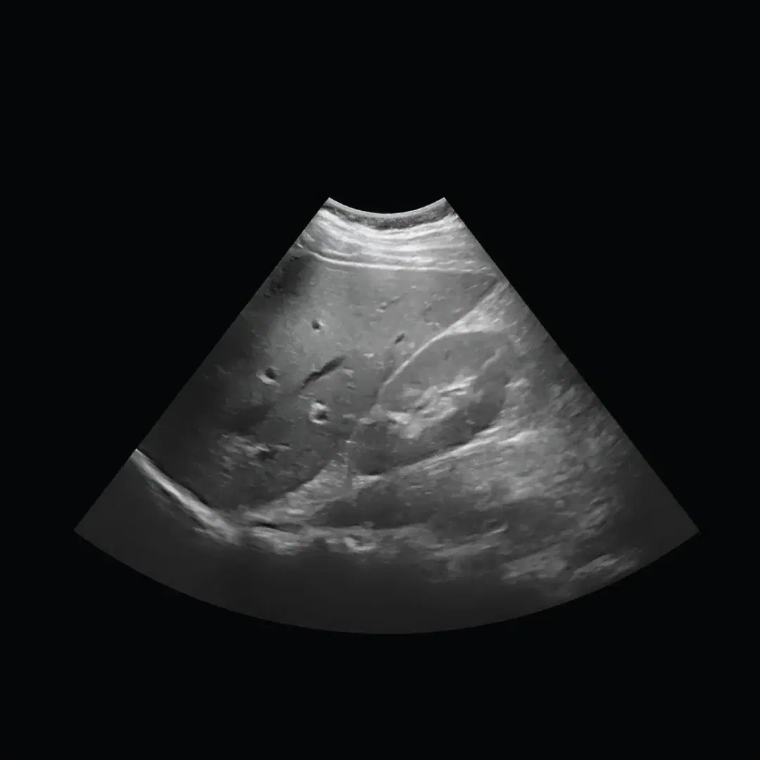 Short Ultrasound Scan